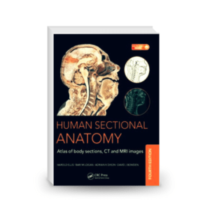 Human sectional anatomy : atlas of body sections, CT and MRI images